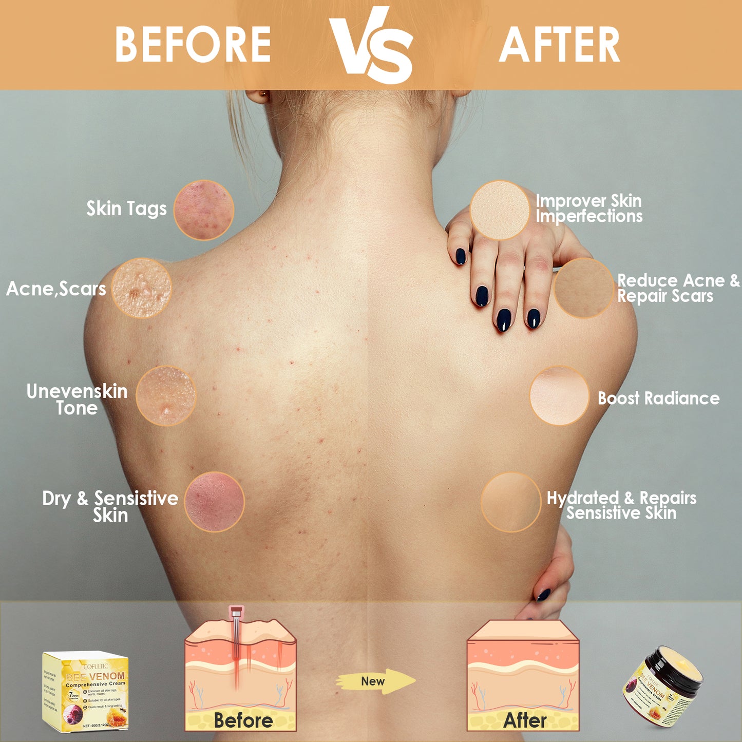 Skin Care Cream Bee Venom